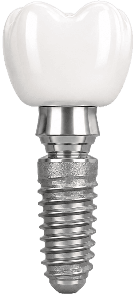 Dental implant with a ceramic crown